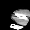 SPORK, NICO - 22.03.1976 - 02.08.2022 - CT obere Extremität - 17:51:17